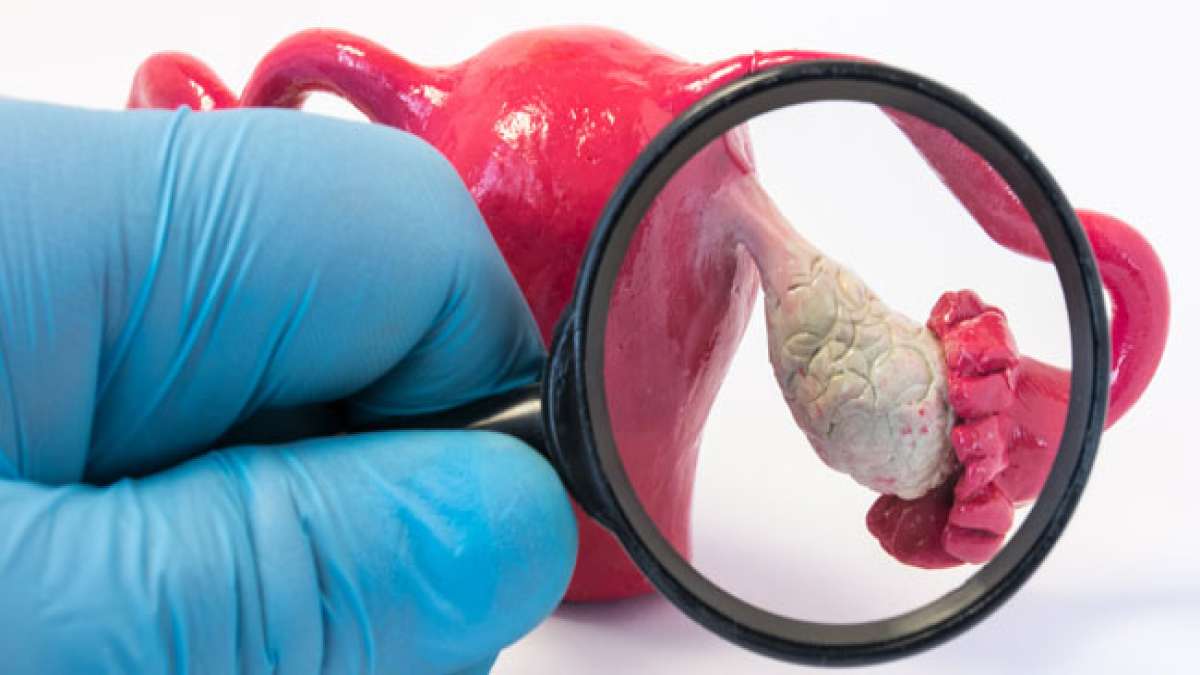 Erfahren Sie mehr über die Sensibilisierung für Eierstockkrebs im Vereinigten Königreich.