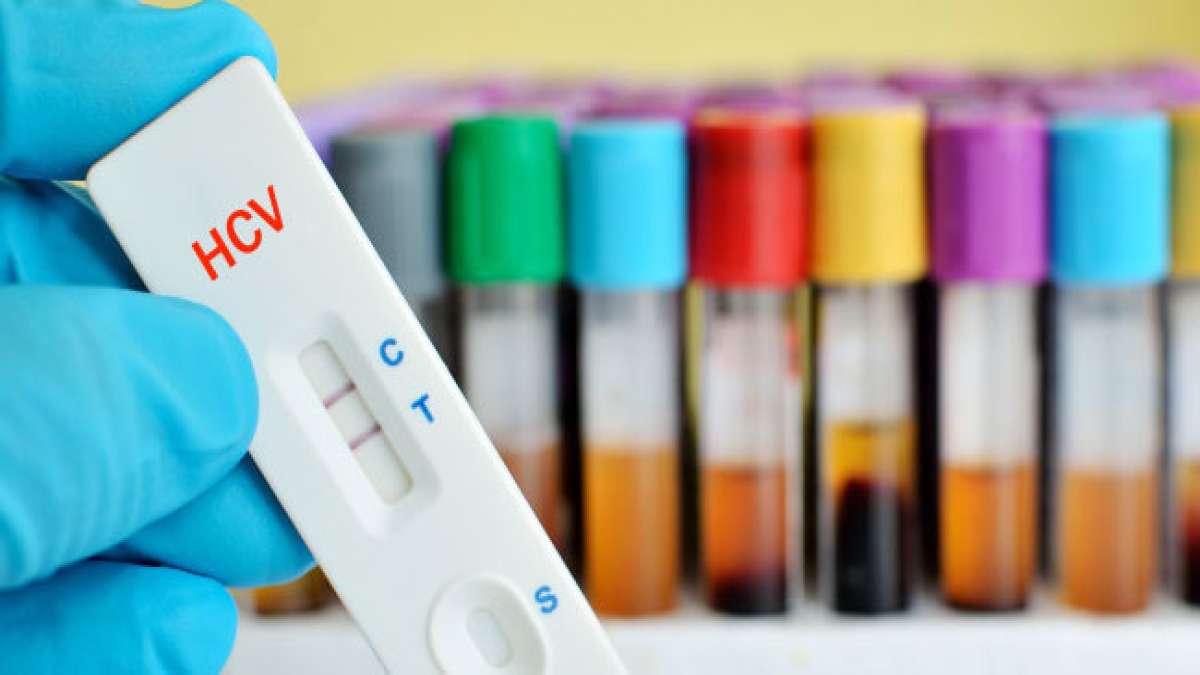 Machen Sie mit am Hepatitis-Testtag in den USA!