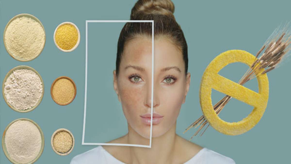 Informieren Sie sich über diese weltweit verbreitete Krankheit und ihre steigende Prävalenz, die Aufmerksamkeit und Unterstützung verdient.