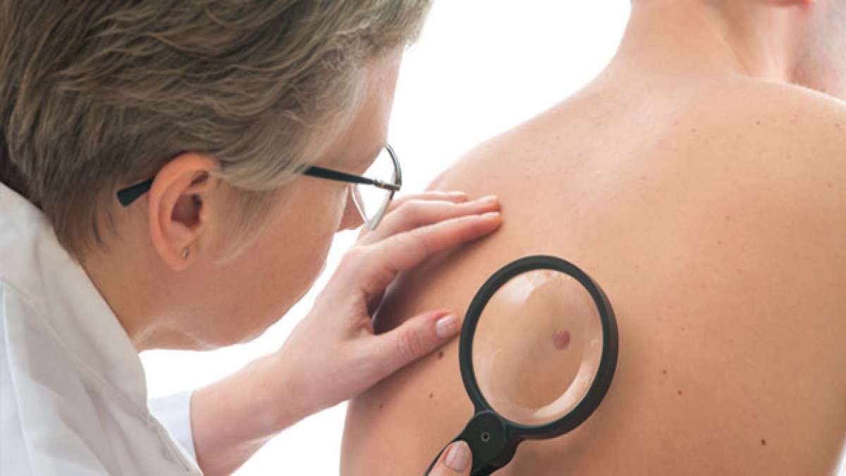 Europäischer Tag zur Prävention von Hautkrebs: Hautkrebs ist eine der am besten behandelbaren Krebsarten, aber er ist auch eine der am häufigsten zu vermeidenden Krebsarten. Europäischer Tag zur Prävention von Hautkrebs: Hautkrebs ist eine der am besten behandelbaren Krebsarten, aber er ist auch eine der am häufigsten zu vermeidenden Krebsarten.