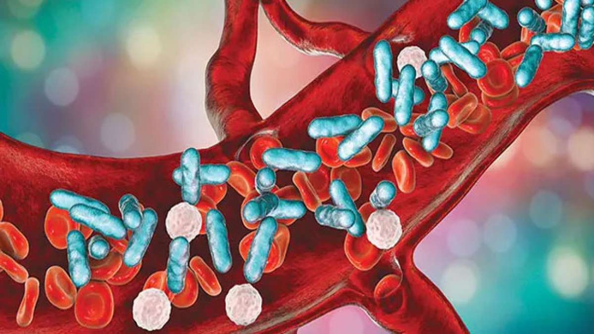 Der Welt-Sepsis-Tag am 13. September ruft zur Bekämpfung einer lebensbedrohlichen Gefahr auf: Sepsis. Jedes Jahr sterben Hunderttausende von Menschen an dieser vermeidbaren Krankheit. Der Welt-Sepsis-Tag am 13. September ruft zur Bekämpfung einer lebensbedrohlichen Gefahr auf: Sepsis. Jedes Jahr sterben Hunderttausende von Menschen an dieser vermeidbaren Krankheit.