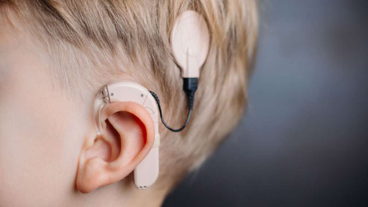 Entdecke die erstaunliche Welt des Cochlea-Implantats am Internationalen Tag des Cochlea-Implantats am 25. Februar.