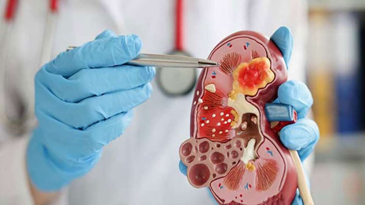 Entdecken Sie die Welt der Nephrologie am Tag der Nephrologen.