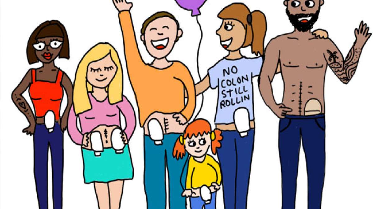 Am ersten Samstag im Oktober wird der Welt-Stoma-Tag begangen. Ziel ist es, Menschen mit Stoma zu unterstützen und ihnen zu zeigen, dass sie nicht allein sind.