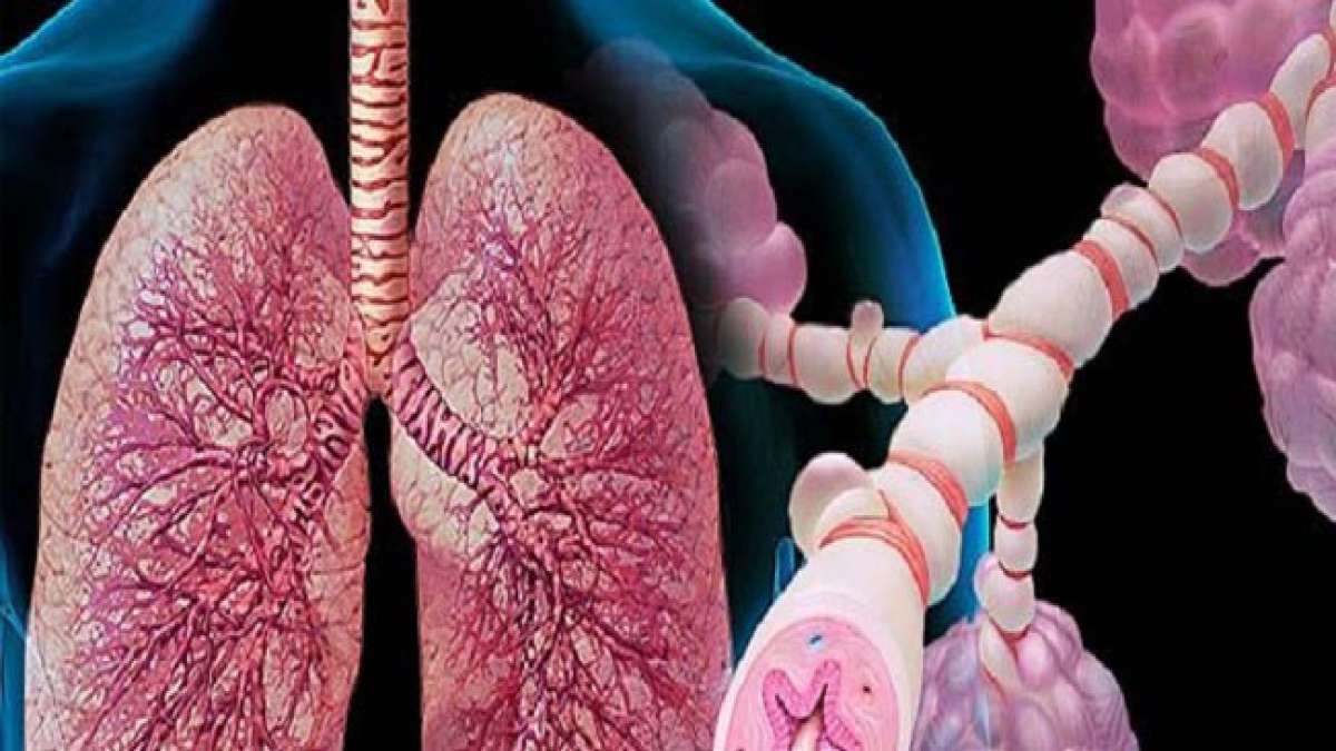 Der Welt-Bronchial-Asthma-Tag am 30. Mai widmet sich einer der weltweit häufigsten chronischen Krankheiten.