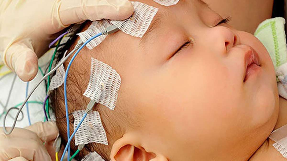 Gemeinsam können wir dazu beitragen, diese schwere Form der Epilepsie besser zu verstehen und Unterstützung und Ressourcen für betroffene Menschen bereitzustellen. Gemeinsam können wir dazu beitragen, diese schwere Form der Epilepsie besser zu verstehen und Unterstützung und Ressourcen für betroffene Menschen bereitzustellen.