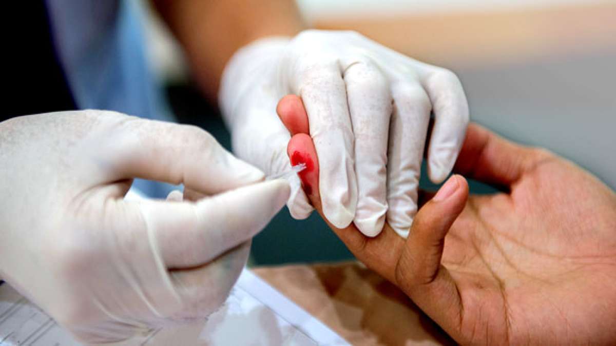 Lassen Sie sich am Nationalen Tag der HIV-Tests (NHTD) am 27. Juni testen und erfahren Sie Ihren HIV-Status. Lassen Sie sich am Nationalen Tag der HIV-Tests (NHTD) am 27. Juni testen und erfahren Sie Ihren HIV-Status.