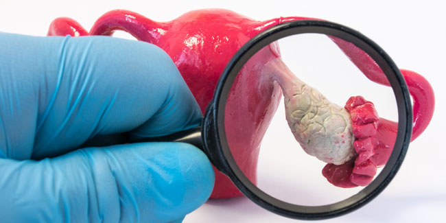 1. März: Monat der Eierstockkrebs-Sensibilisierung: Warum Schweigen gefährlich ist