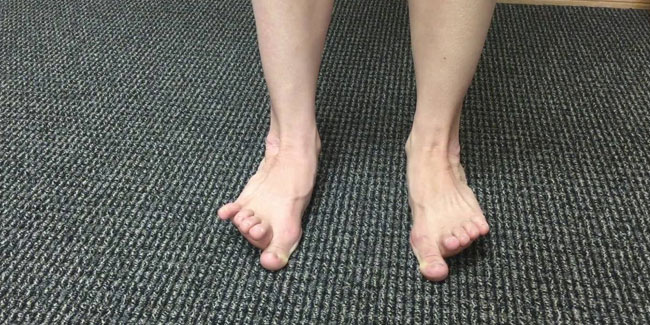 6. August: Tag der Wackelnden Zehen