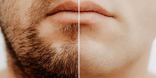 18. Oktober: Tag ohne Bart