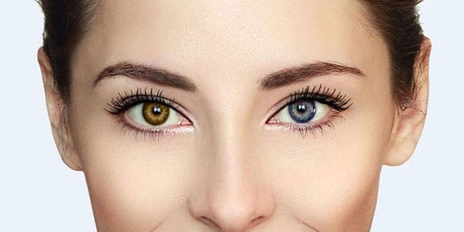 12. Juli: Tag der verschiedenfarbigen Augen