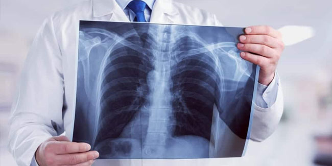 8. November - Tag der Röntgenstrahlen