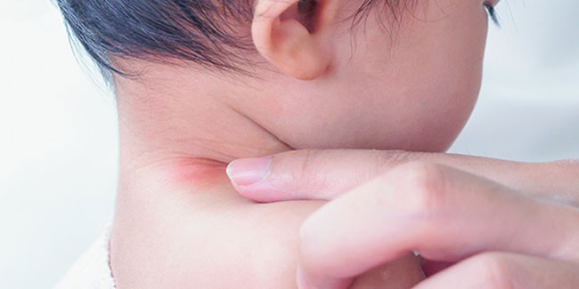 14. September: Welttag des Atopischen Ekzems