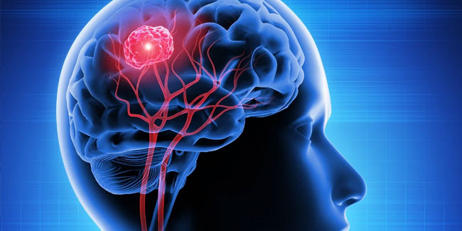 8. Juni: Welt-Hirntumortag