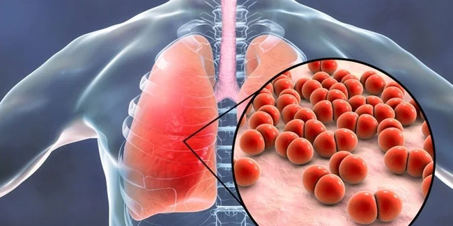 12. November: Welt-Lungenentzündungstag
