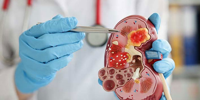 27. März: Nephrologen-Tag