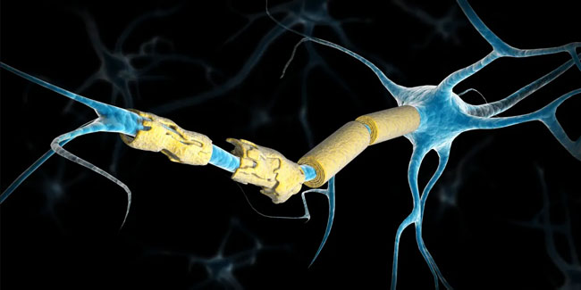 30. Mai: Welt-Multiple-Sklerose-Tag