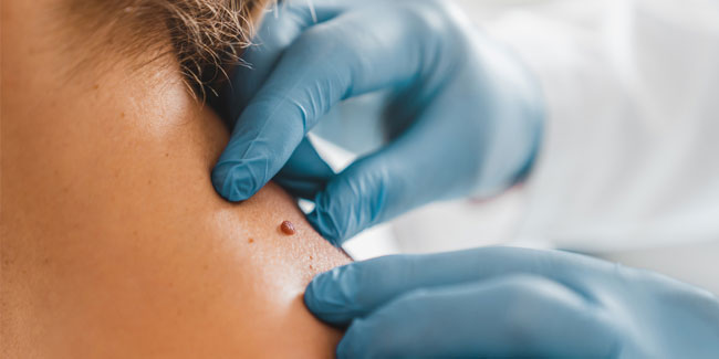 15. September: Welt-Lymphom-Tag