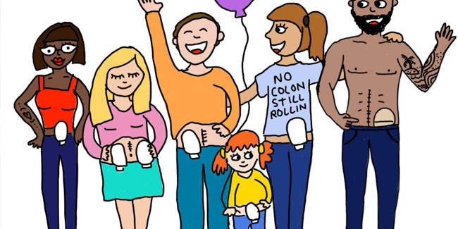 3. Oktober: Tag des Stoma-Bewusstseins