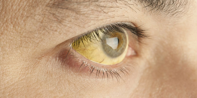 28. Juli: Welt-Hepatitis-Tag