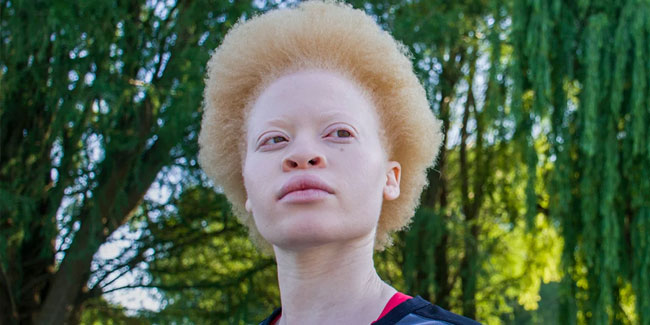 13. Juni - Internationaler Tag zur Sensibilisierung für Albinismus